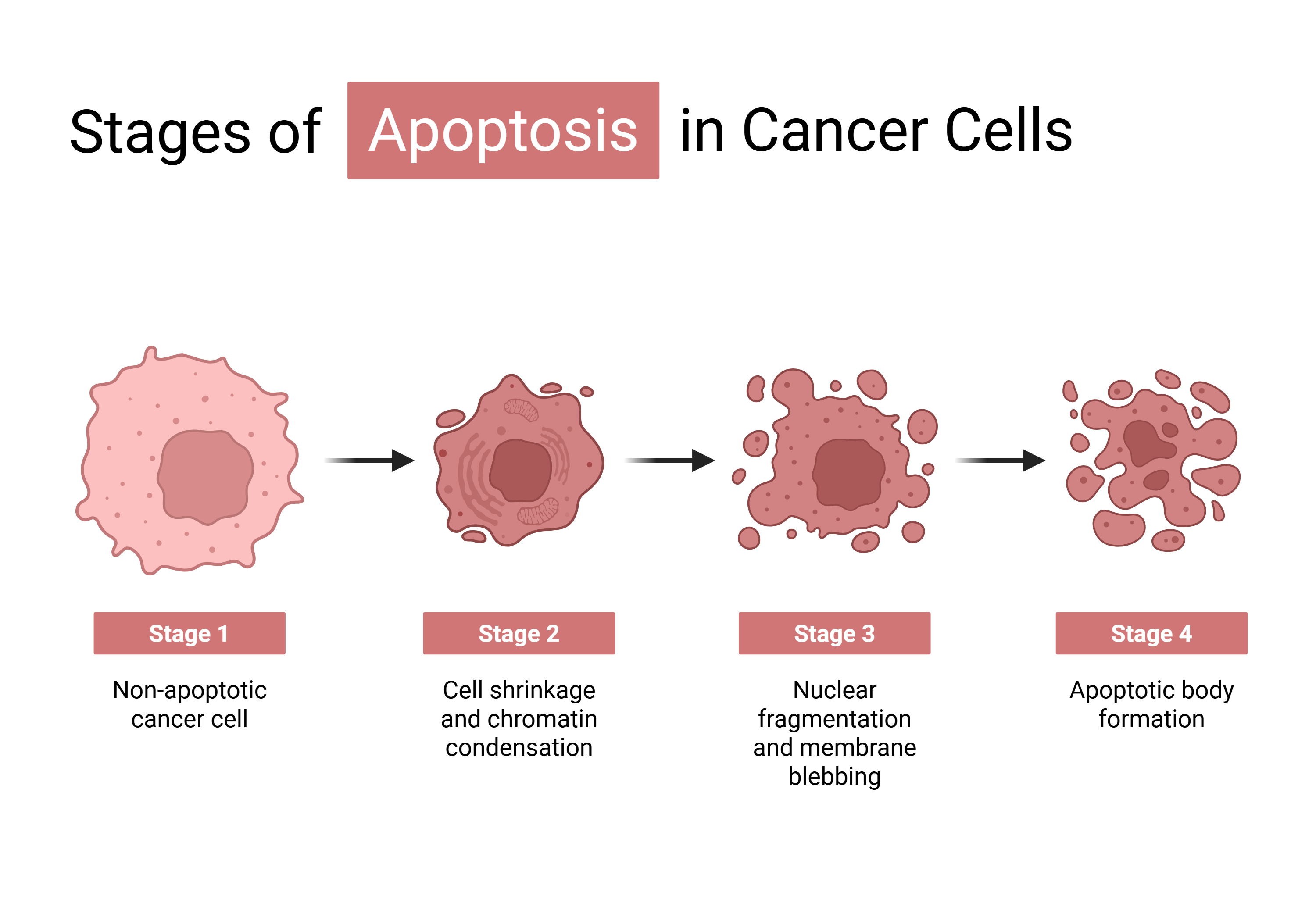 癌细胞发生 apoptosis 的形态阶段