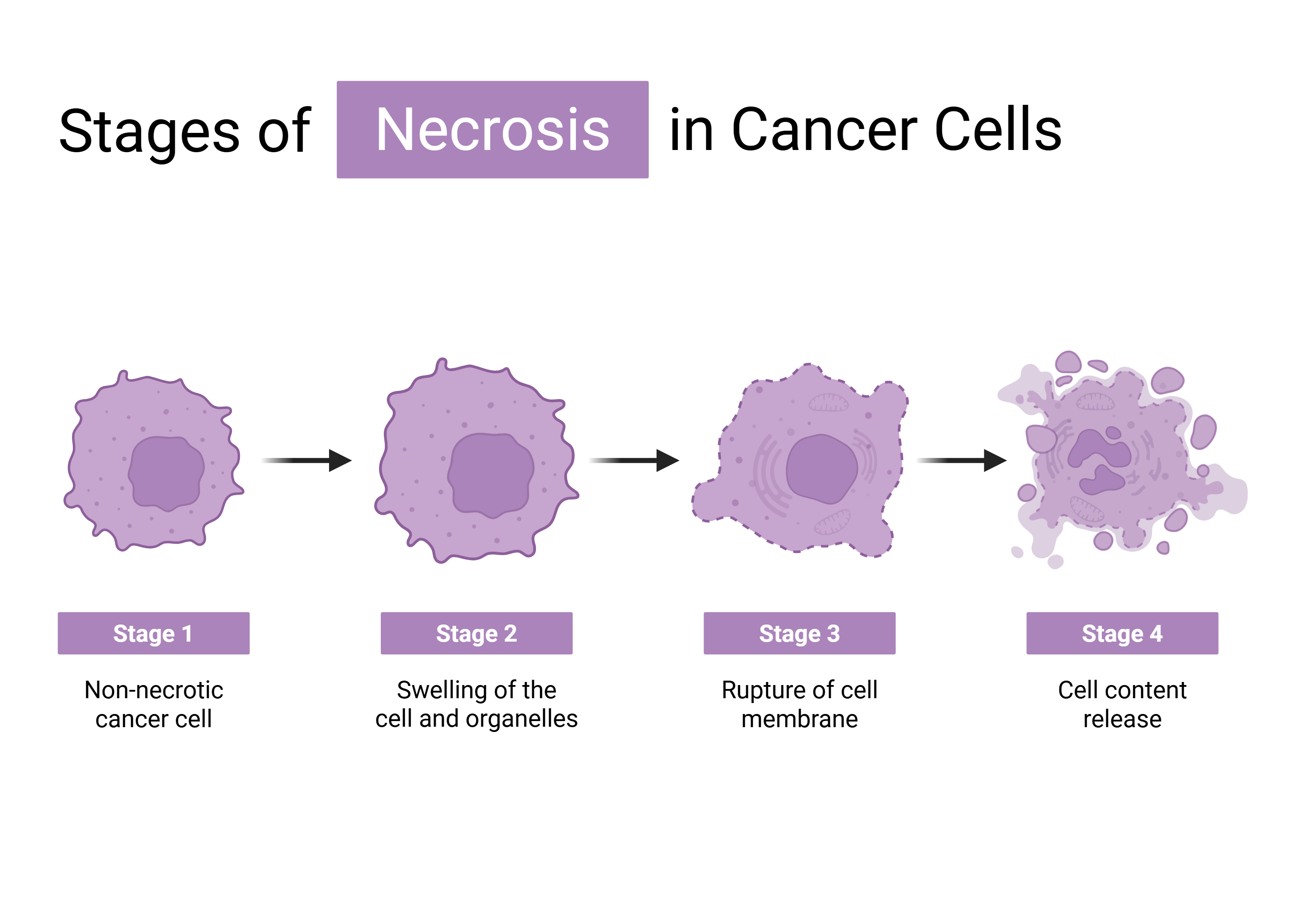 癌细胞发生 necroptosis-like death 的形态阶段